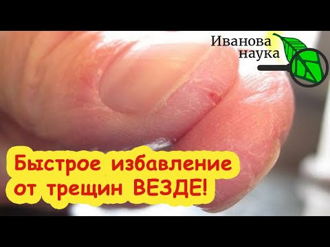 ДЕШЕВАЯ ЗАМЕНА ДОРОГИМ СРЕДСТВАМ! Продается в любой аптеке и заживляет даже глубокие раны.