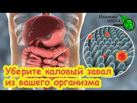 СТОЛОВАЯ ЛОЖКА В ДЕНЬ ИЗБАВИТ ОТ ЗАПОРА и ВОСПАЛЕНИЯ В КИШЕЧНИКЕ. Вот почему Гутталакс не работает. СТОЛОВАЯ ЛОЖКА В ДЕНЬ ИЗБАВИТ ОТ ЗАПОРА и ВОСПАЛЕНИЯ В КИШЕЧНИКЕ. Вот почему Гутталакс не работает.