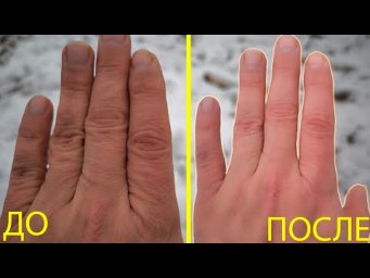 ДЕШЁВОЕ АПТЕЧНОЕ СРЕДСТВО с МОМЕНТАЛЬНЫМ ЭФФЕКТОМ: восстановление сухой и чувствительной кожи.