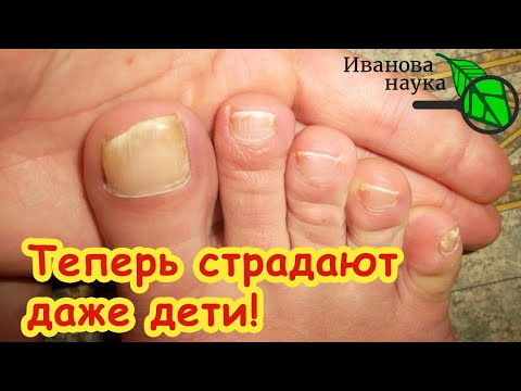 ХОТИТЕ ИЗБАВИТЬСЯ ОТ ГРИБКА НАВСЕГДА? Без ЭТОГО вам не избавиться от него НИКОГДА! ХОТИТЕ ИЗБАВИТЬСЯ ОТ ГРИБКА НАВСЕГДА? Без ЭТОГО вам не избавиться от него НИКОГДА!